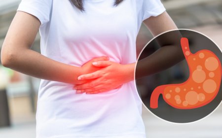 Gyomorsav túltengés és reflux: Okok, megelőzés és gyógynövények