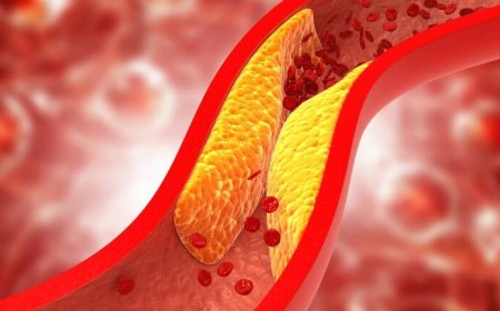 Gyógynövények, amelyek csökkentik a koleszterinszintet