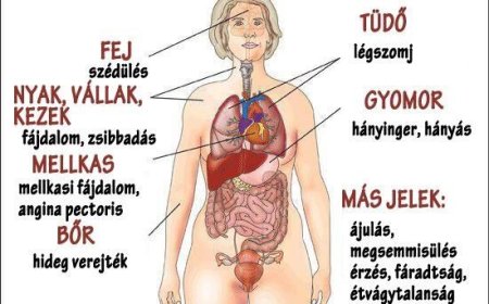 Szívinfarktus tünetei