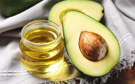 Az avokádó, az "egészséges zsírkirály": Miért érdemes fogyasztani és mik a jótékony hatásai?
