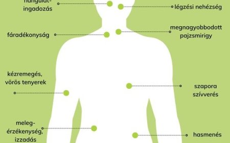 A pajzsmirigy túlműködés tünetei